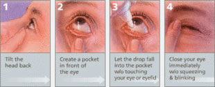 4 Types of Eye Drops and How to Safely Put Them In