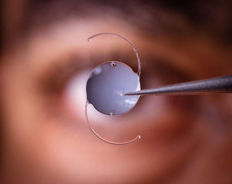intraocular-lens-being-held-in-front-of-eye